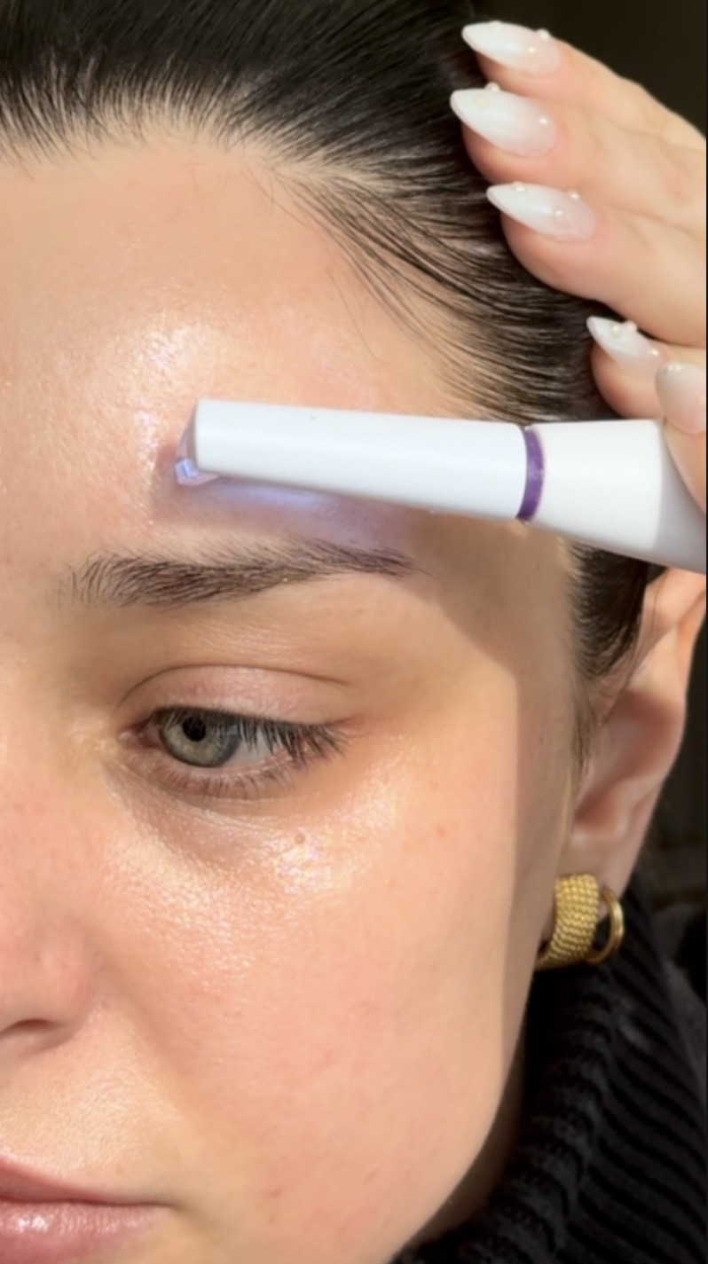 How to Use the Michael Todd Microdermabrasion Tip (Microsmooth) on the Sonicsmooth Pro+